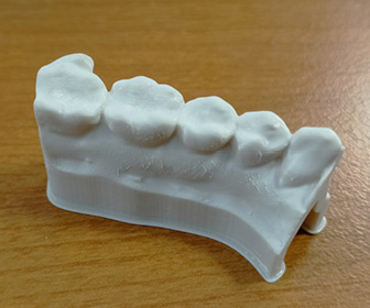 Modèle orthodontique en résine biocompatible LCD